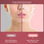 Massageador Facial para Queima de Gordura - Slim Face® - Acessórios Importados - Cuidado Pessoal- Novidades - SANTO STILO