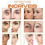 lifting facial, antienvelhecimento, antiaging, antiidade, rugas, linhas de expressão, skincare, cuidados com a pele, sérum