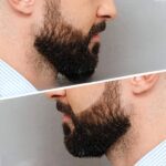preencher barba